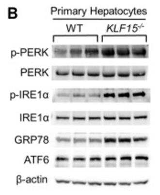 Detection of IRE1 alpha in WT and KLF15-/- Mouse Hepatocytes by Western Blot